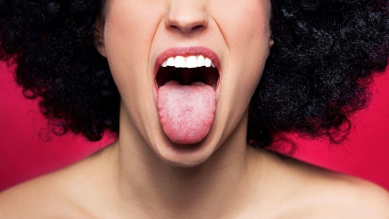 identificar enfermedad de lengua
